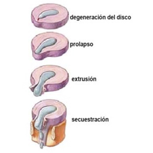 001-hernoia-dic-3-2015