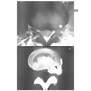 001-hernoia-dic-4-2015