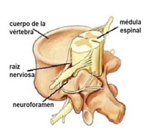 01-discopatia-cervical-dic-3