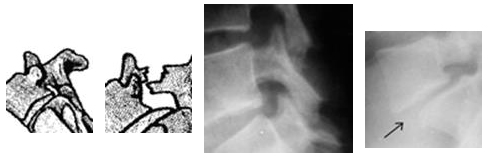 01-espondiolistesis-dic1