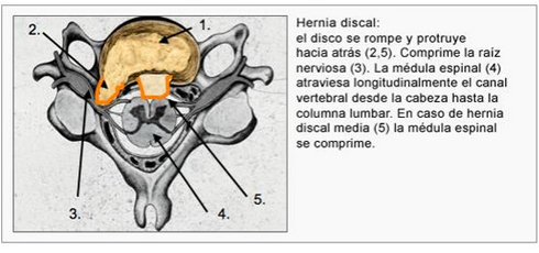01-h-cervicales-dic-1