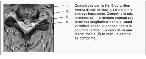01-h-cervicales-dic-2
