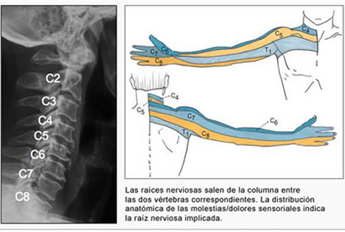 01-h-cervicales-dic-3