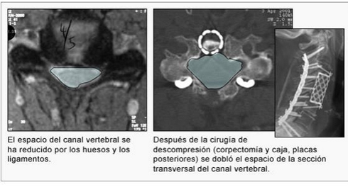 01-h-cervicales-dic-4