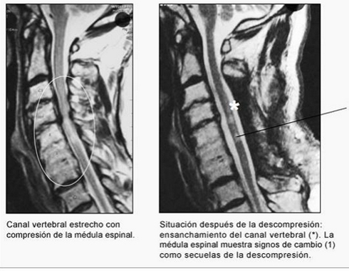 01-h-cervicales-dic-5
