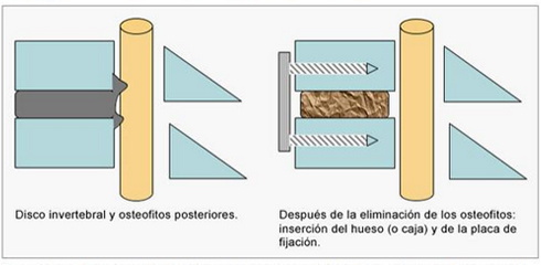 01-h-cervicales-dic-6