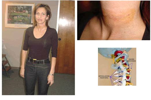 01-hernia-16-2-enero