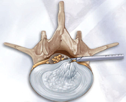 a-01cirugia-endos999