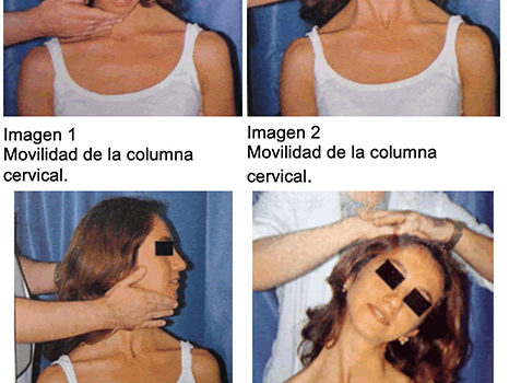 CERVICOBRAQUIALGIA