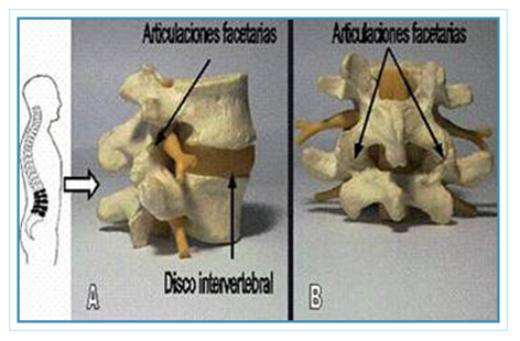 Los bloqueos facetario y radicular selectivo hechos con tecnología existente hoy, son indoloros Los bloqueos facetario y radicular selectivo hechos con tecnología existente hoy, son indoloros