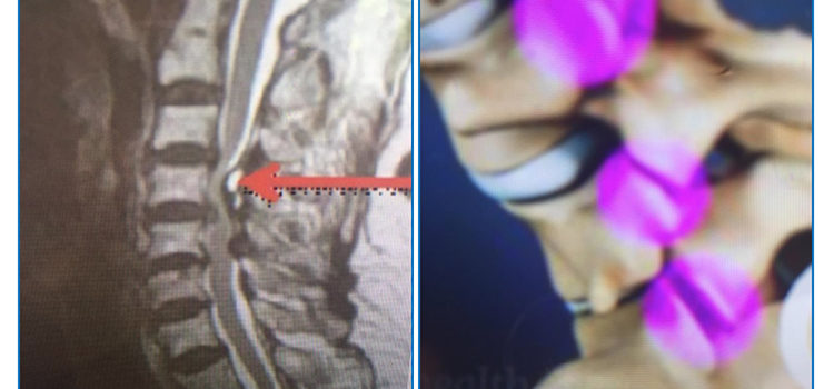 CAUSAS DE DOLOR CERVICAL CAUSAS DE DOLOR CERVICAL